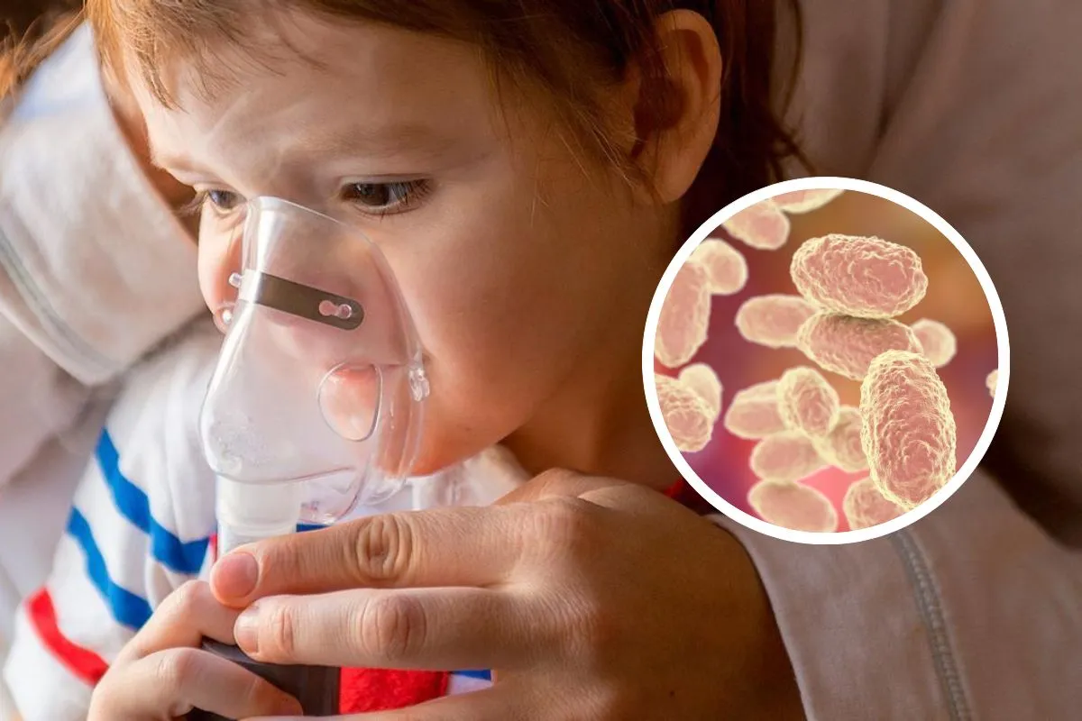 Detectan 288 casos de tos ferina en México: ¿Qué es y a quién afecta?