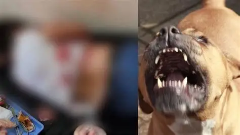 Niño de 4 años herido por Pitbull en Acatlán; dueños esconden al animal tras el ataque