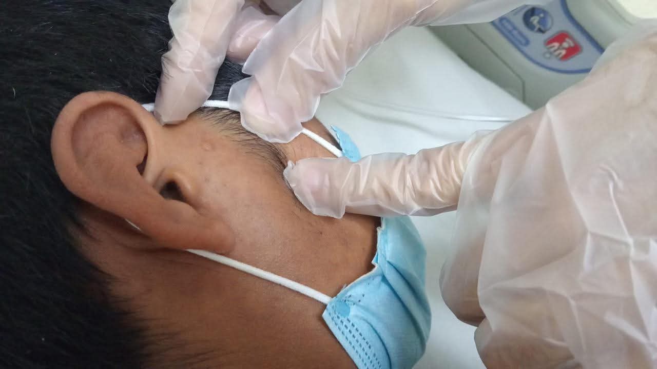 Tlaxcala confirma 10 casos de sarampión y un fallecimiento