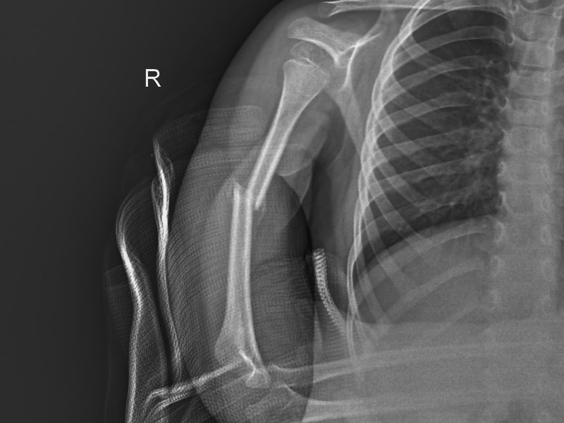 Denuncian omisión para responder por lesiones de alumno